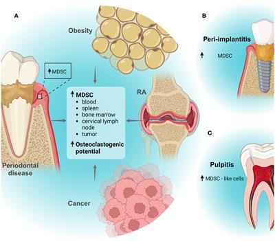 Modulation of myeloid-derived suppressor cell functions by oral inflammatory diseases and important oral pathogens